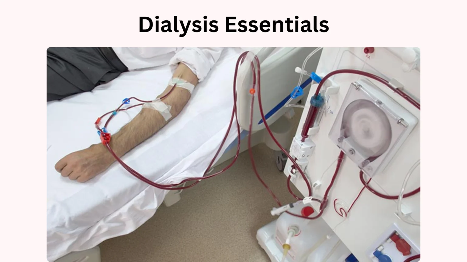 Dialysis Essentials